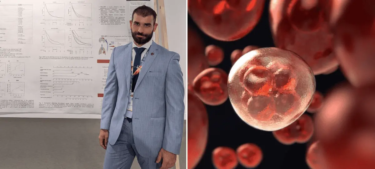 andreas Koulouris rakovina