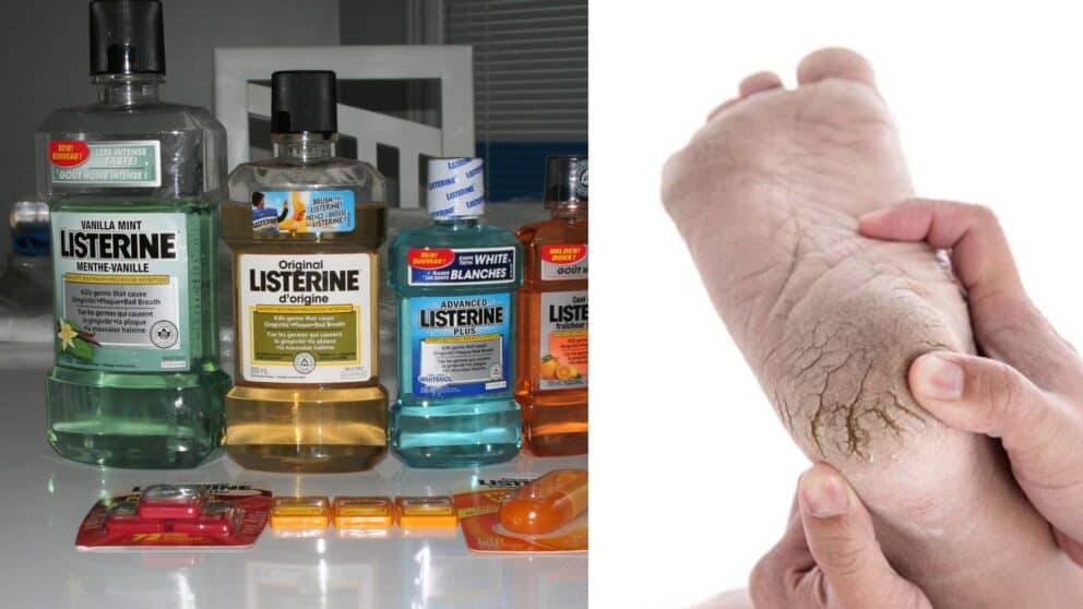 Listerine, nohy