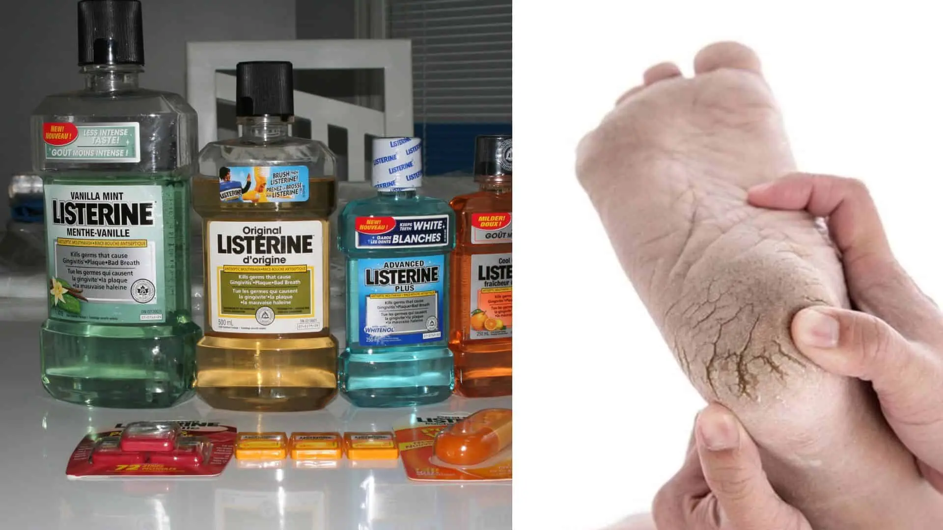 Listerine, nohy