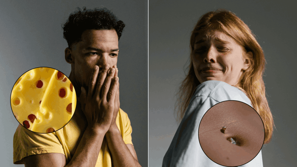 10 najbizarnejsich fobii