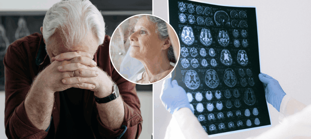 Alzheimerova choroba, starnutie, príznaky