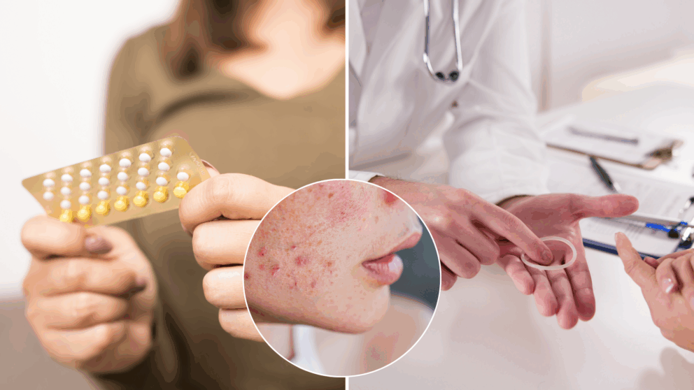 antikoncepcia, vysadenie, príznaky