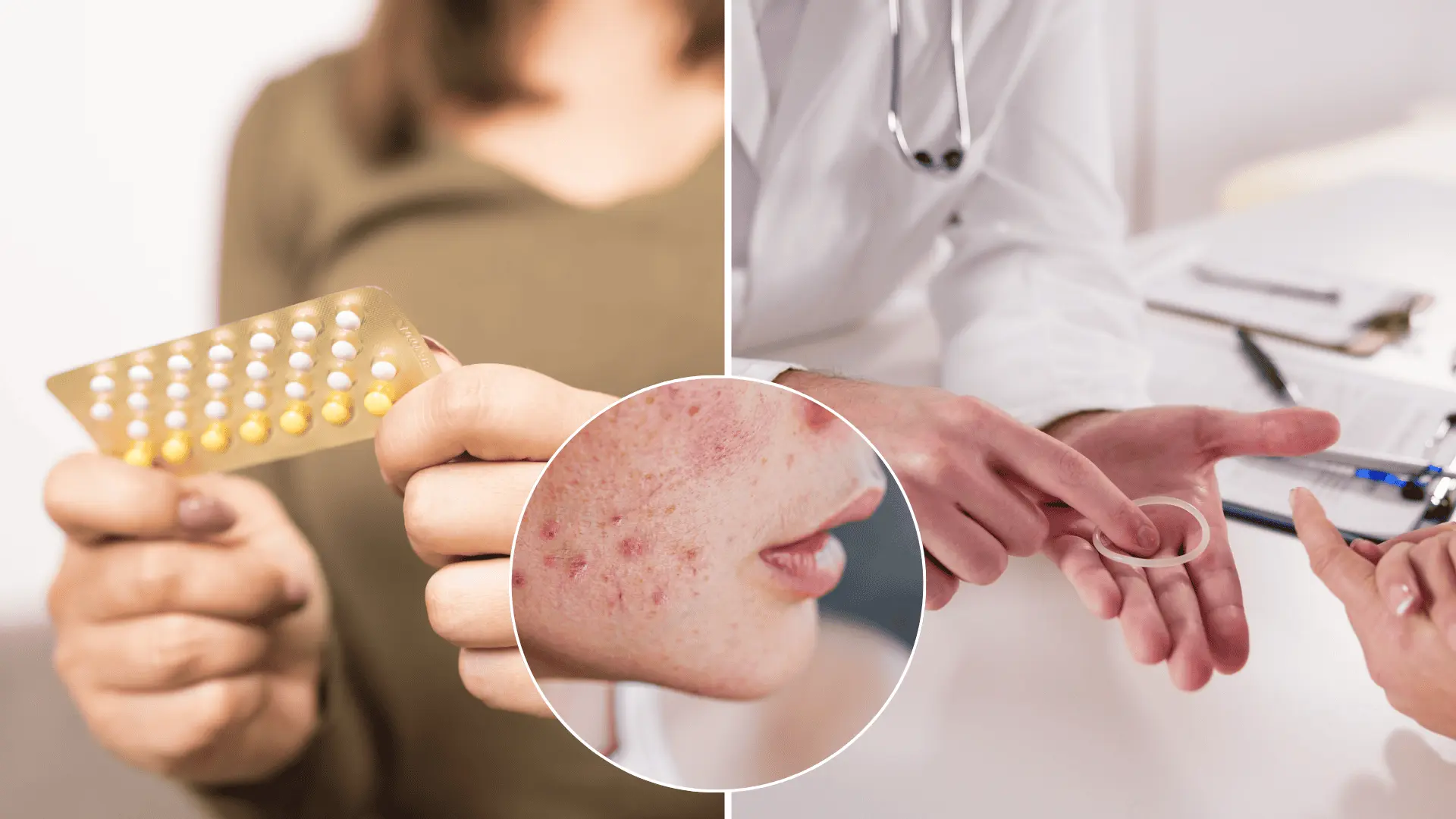 antikoncepcia, vysadenie, príznaky