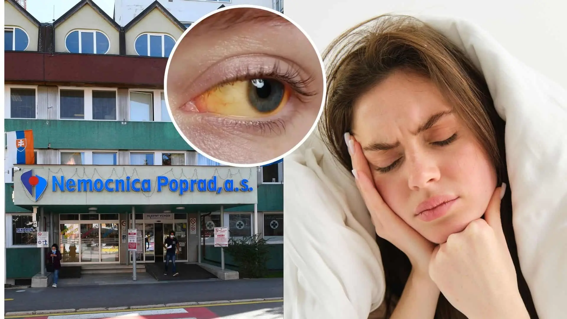 Popradskú nemocnici trápi žltačka typu A.