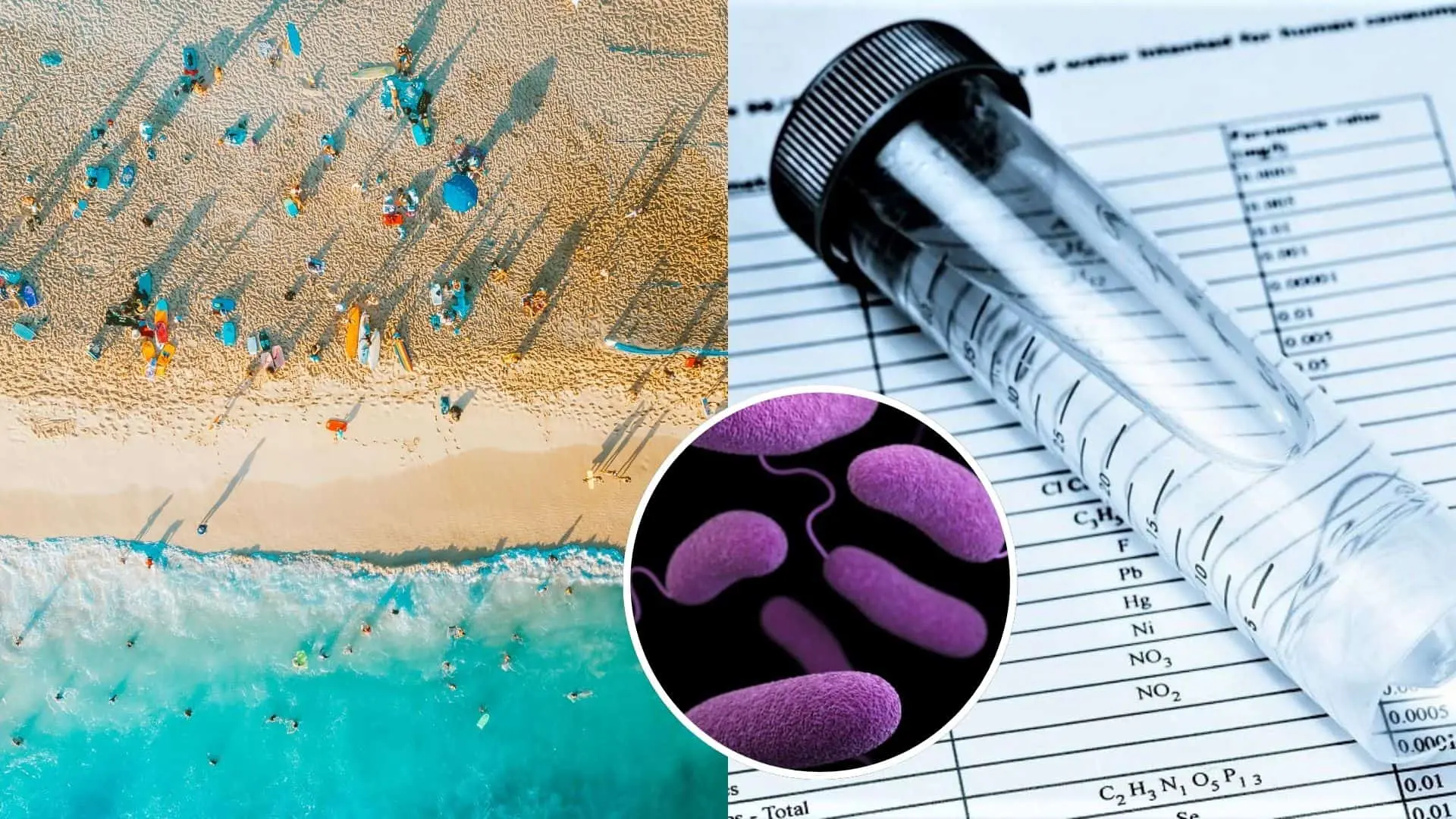 Baktérie rodu Vibrio môžu spôsobovať rôzne ochorenia.