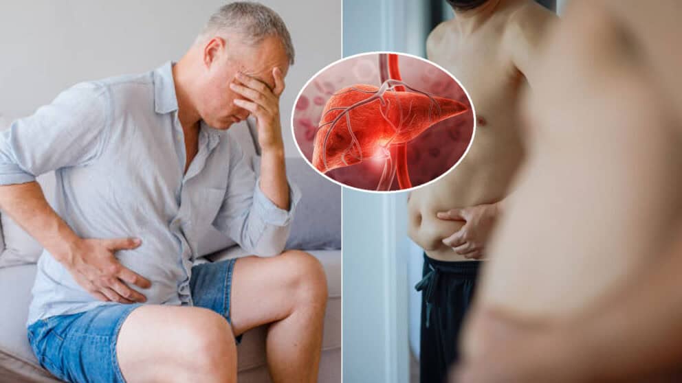 pečeň bolesť tuk nadváha