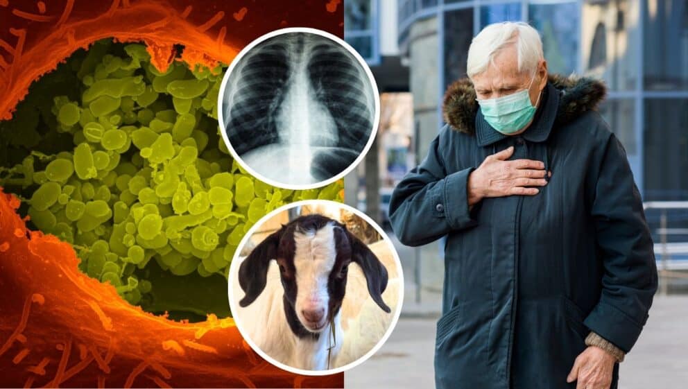 Hygienici odhalili baktériu, s ktorou sa nestretli celé desaťročia