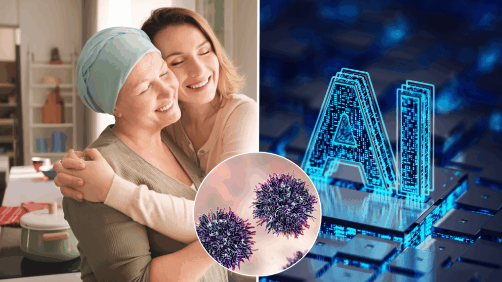 rakovina, liečba, umelá inteligencia