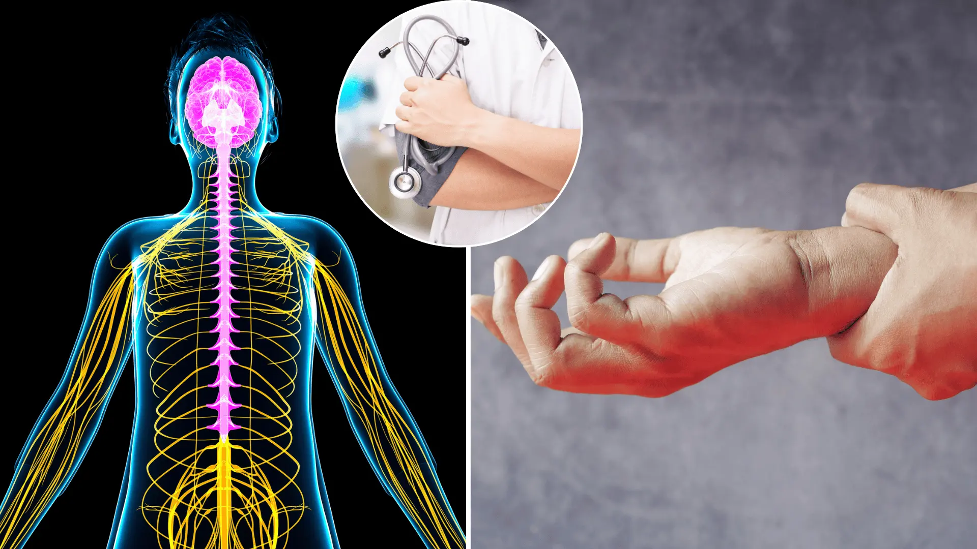 nervy, nervová sústava, príznaky