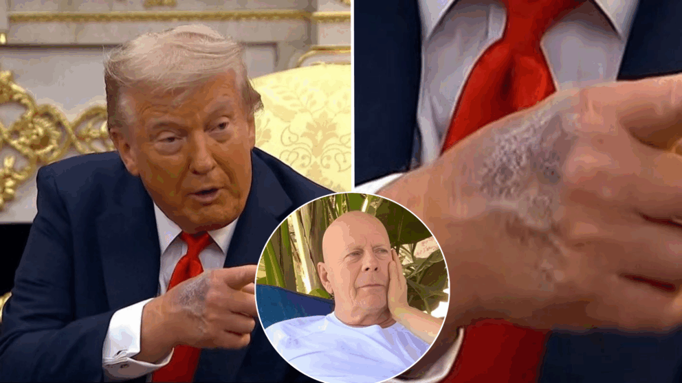 Trump, choroba, Bruce Willis