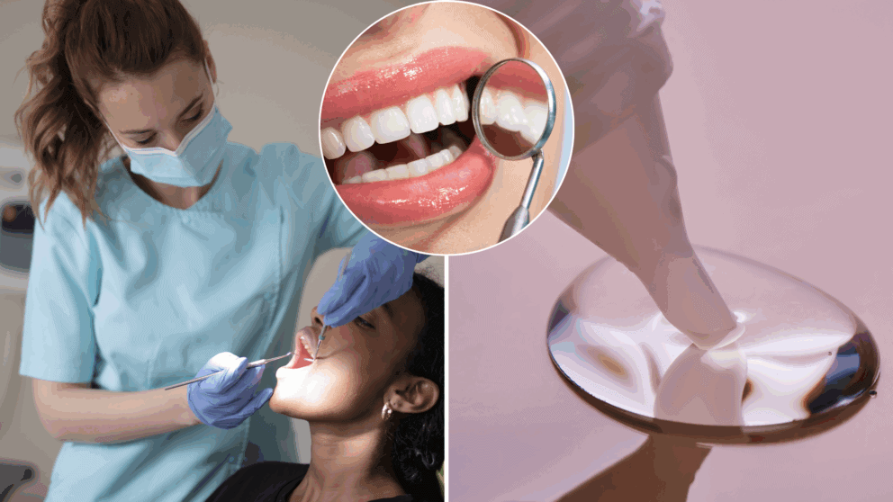 zubárka, sekundové lepidlo