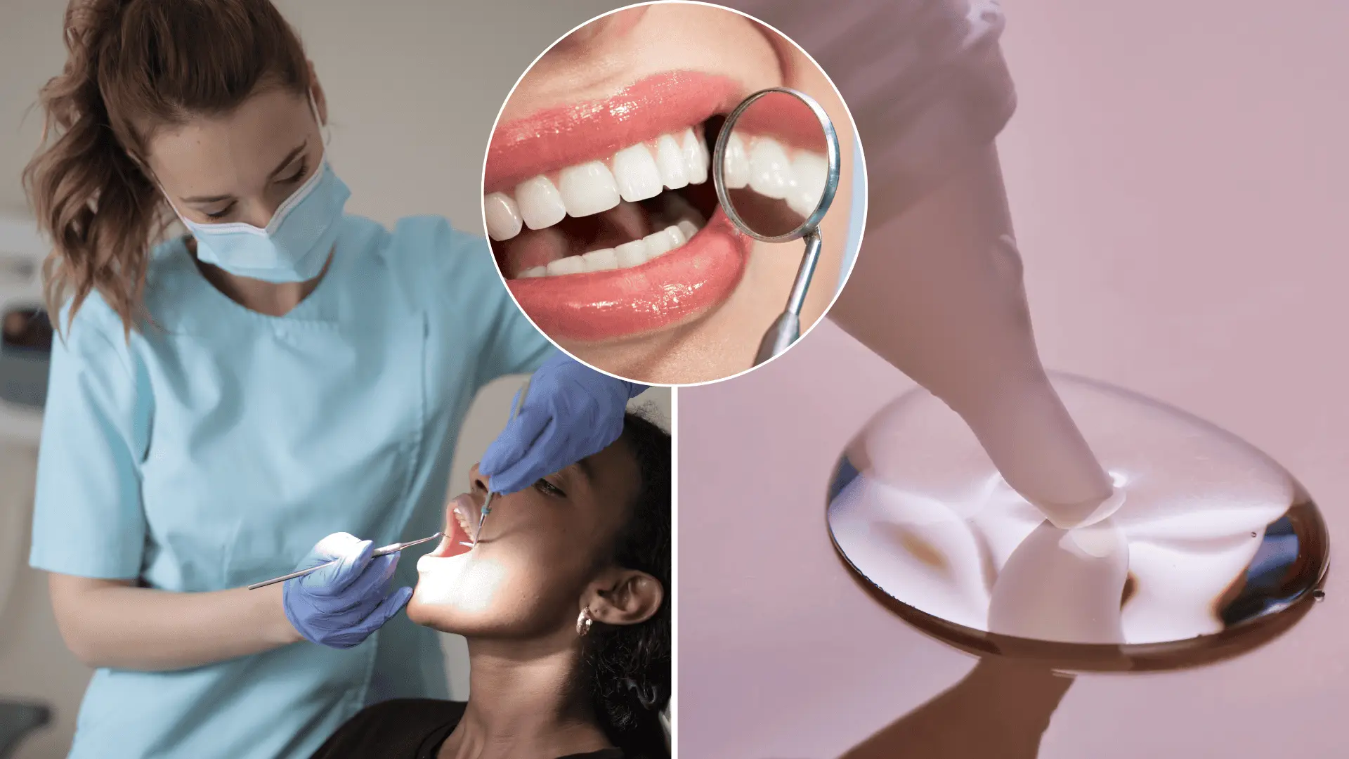 zubárka, sekundové lepidlo