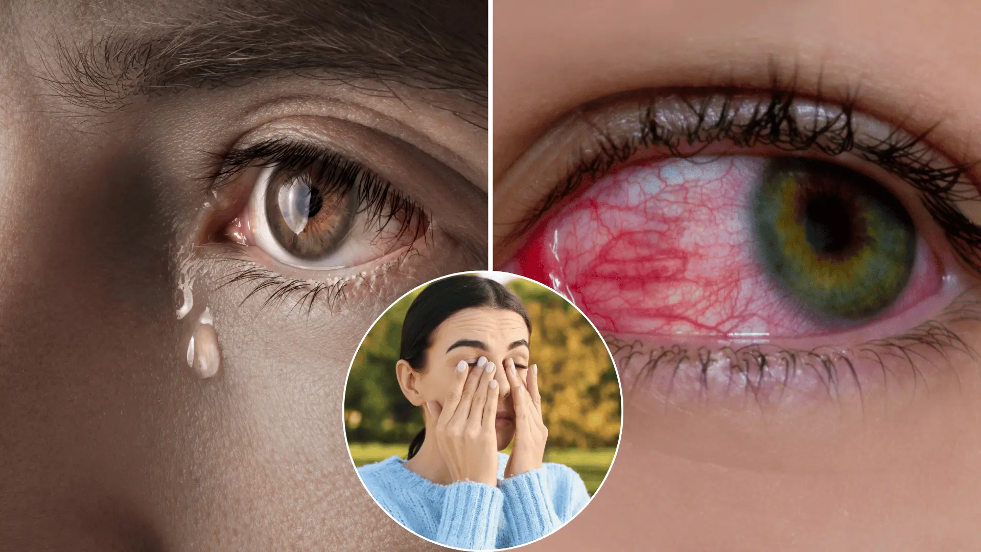 oči, slzenie, začervenanie