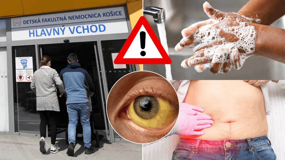 žltačka nemocnica