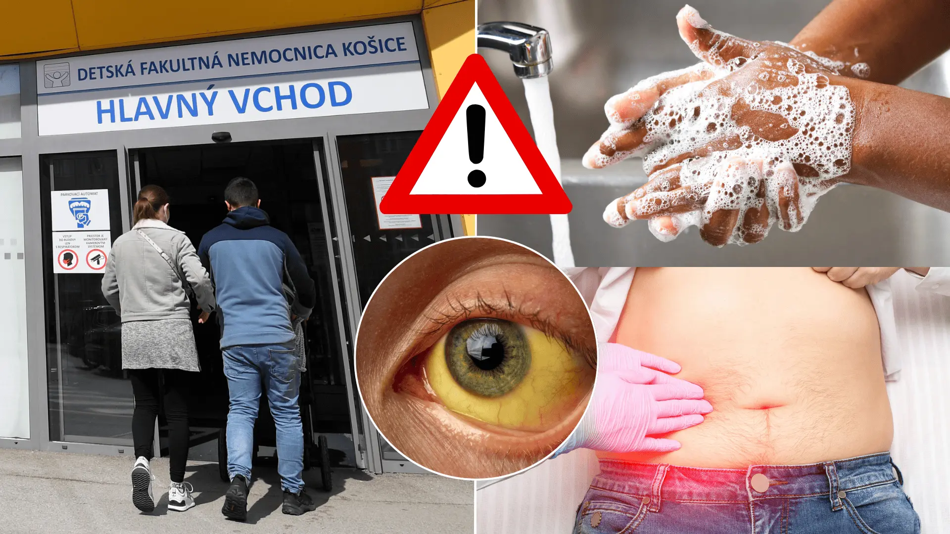 žltačka nemocnica