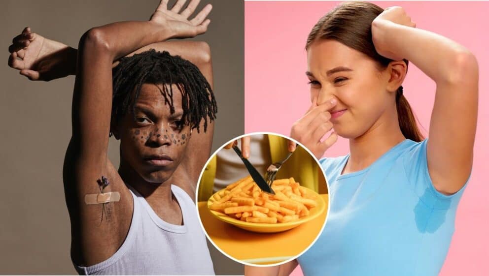 Nadmerné potenie trápi tisíce ľudí. Zdroj: Freepik