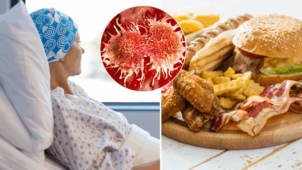 rakovina, hrubé črevo, potraviny