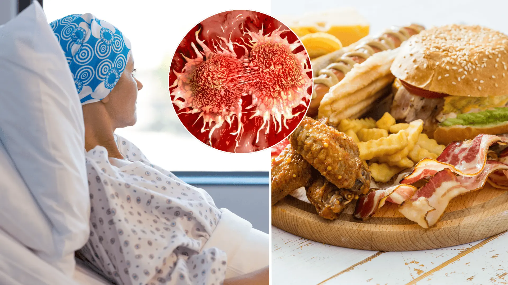 rakovina, hrubé črevo, potraviny