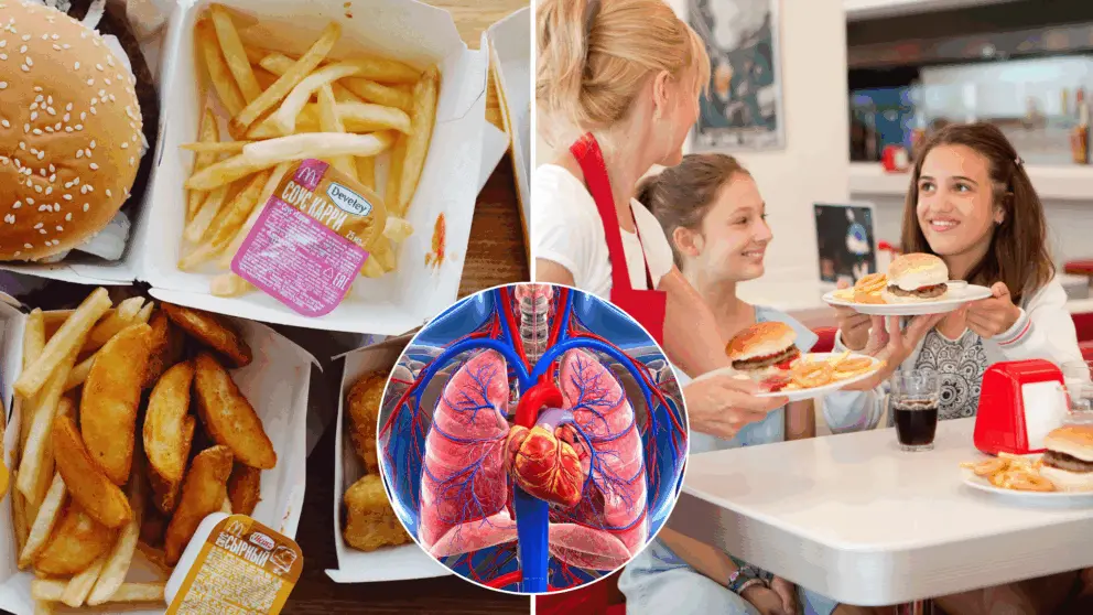 fast food, zdravie