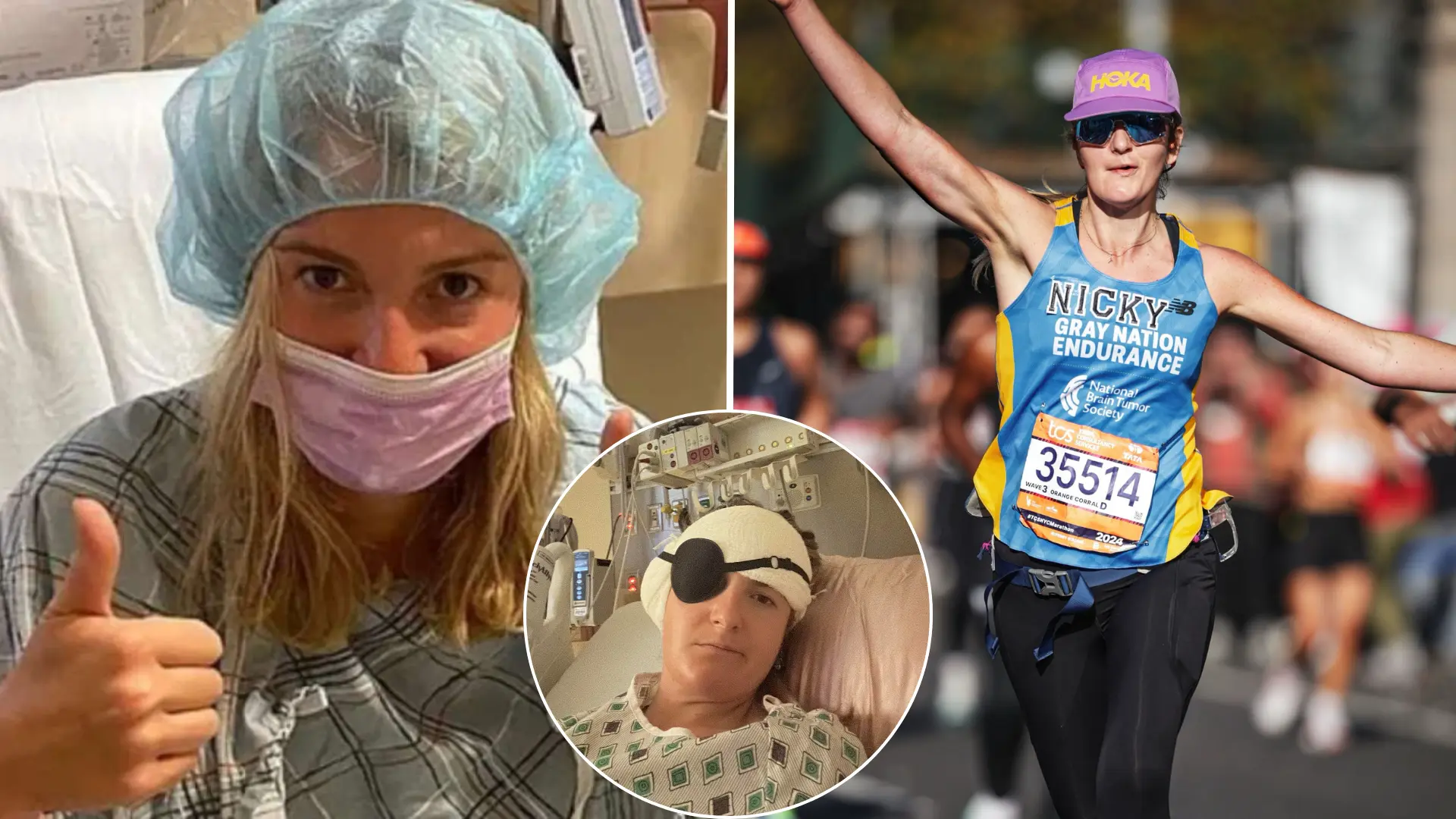 nádor, mozog, sluch, zaľahnutie v ušiach