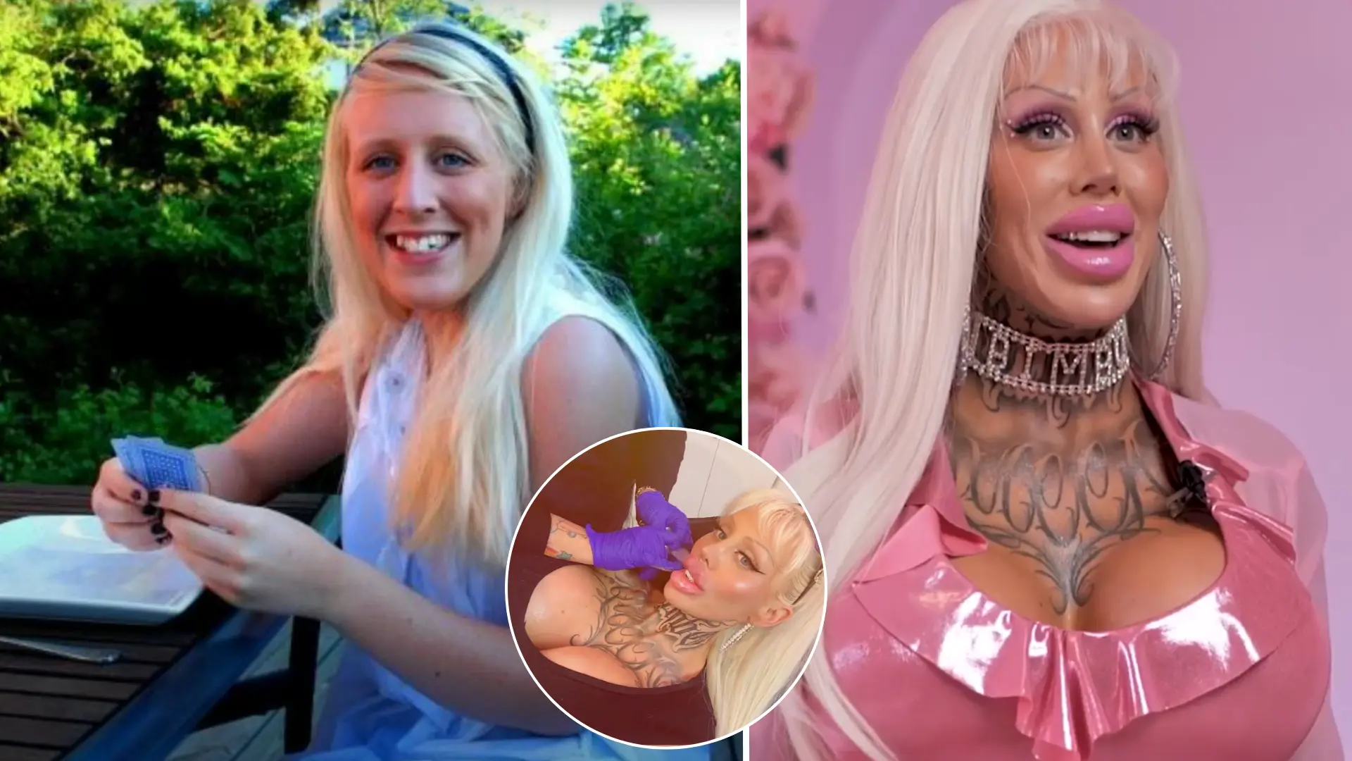 žena, živá Barbie, plastiky