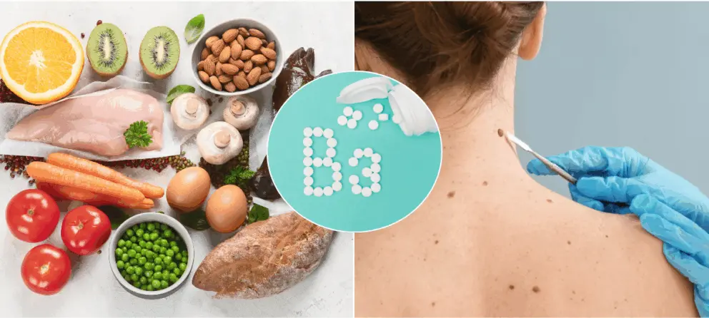 vitamín b3, rakovina kože