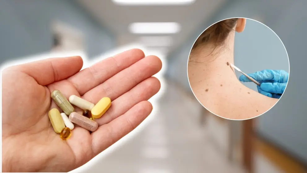 vitamín rakovina kože