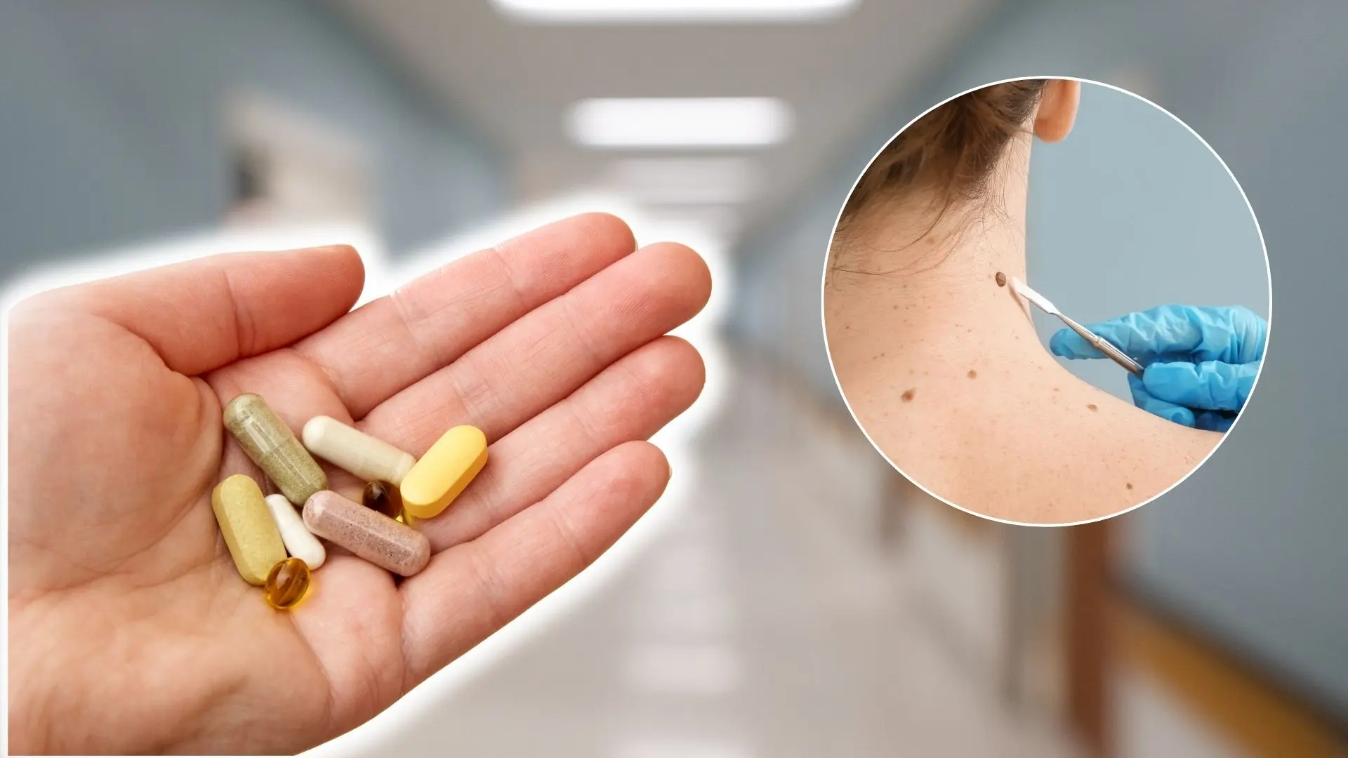 vitamín rakovina kože