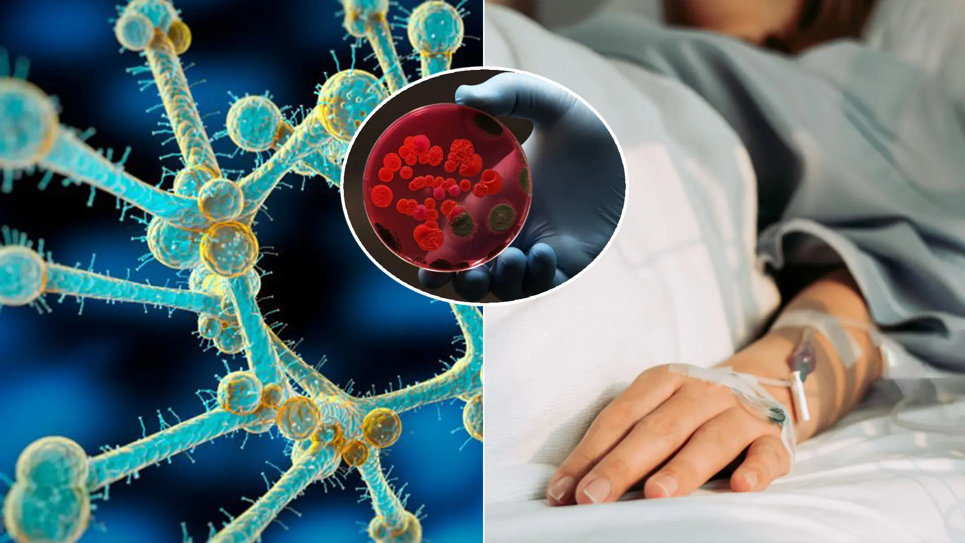 Candida auris infekcia kvasinka žena nemocnica