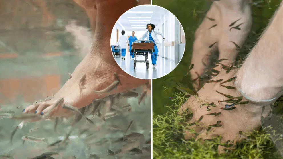 pedikúra, baktéria, rybky